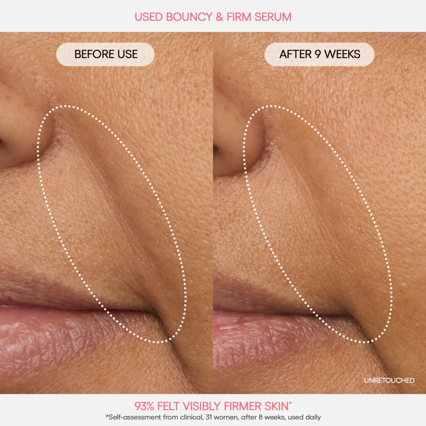 Bouncy Firm Serum
