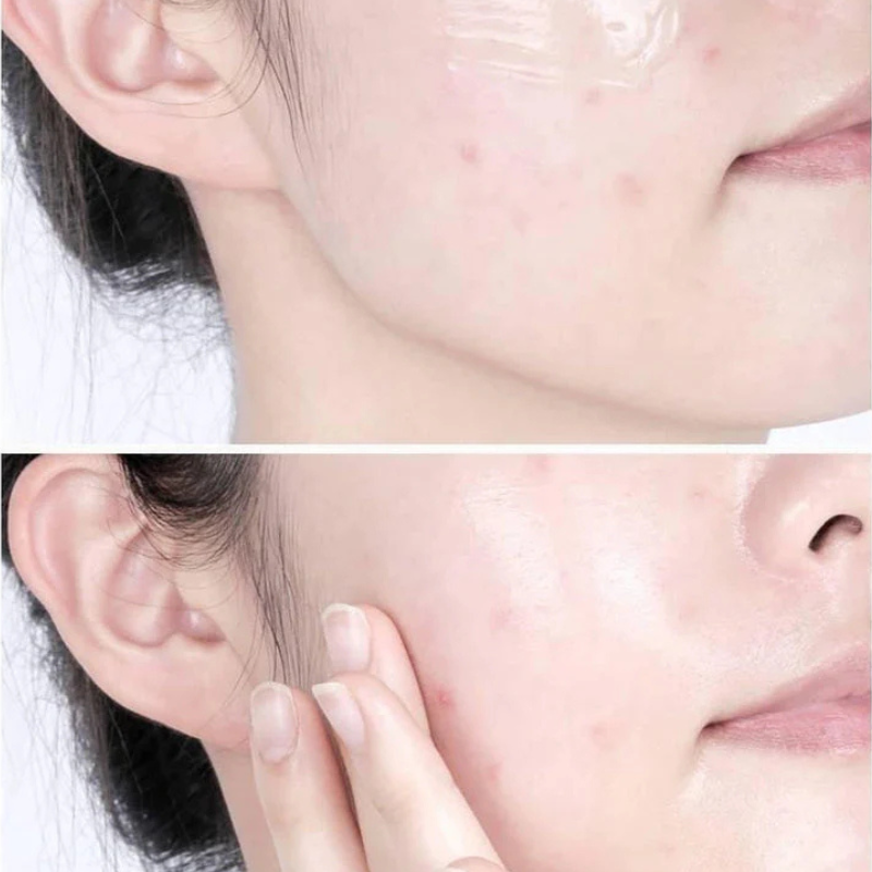 Cica Cream